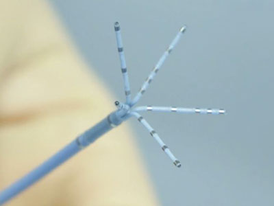 Ablation-catheter