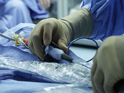 Ablation-catheter-insertion