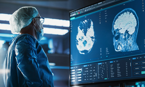 Medical team reviewing brain scan images