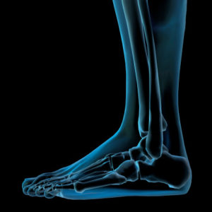 X-ray-of-a-foot-300x300